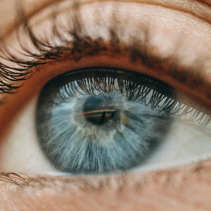 GLAUCOMA